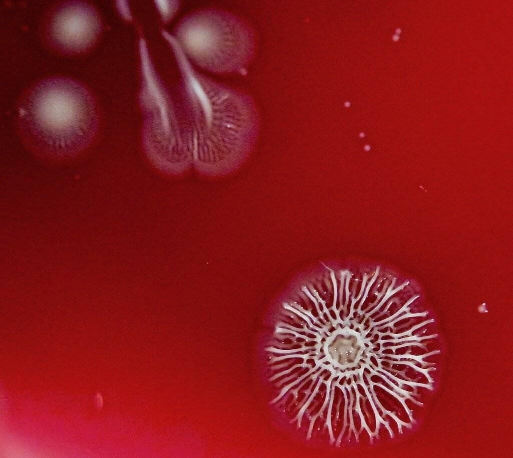 Colonies bactériennes, visibles, elles, à l’oeil nu : des milliards de bactéries échafaudent cette étrangeté.