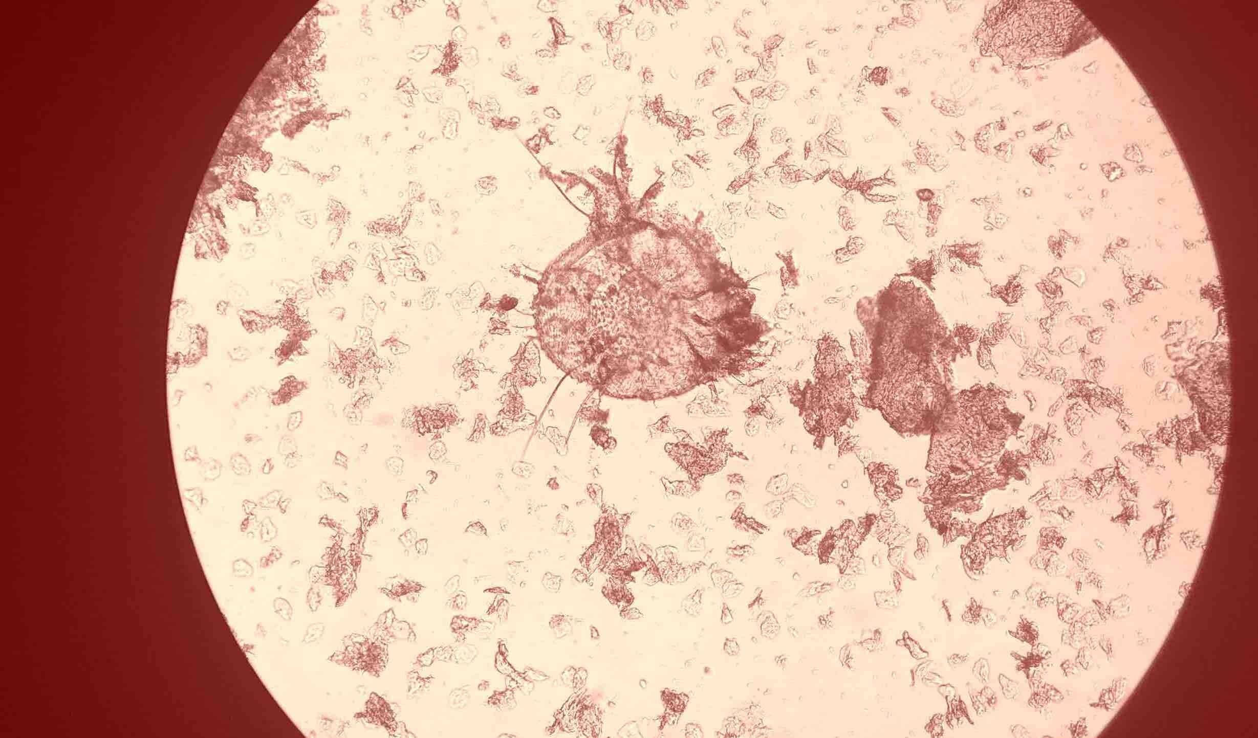 L’agent de la gale : un acarien à la limite de la visibilité