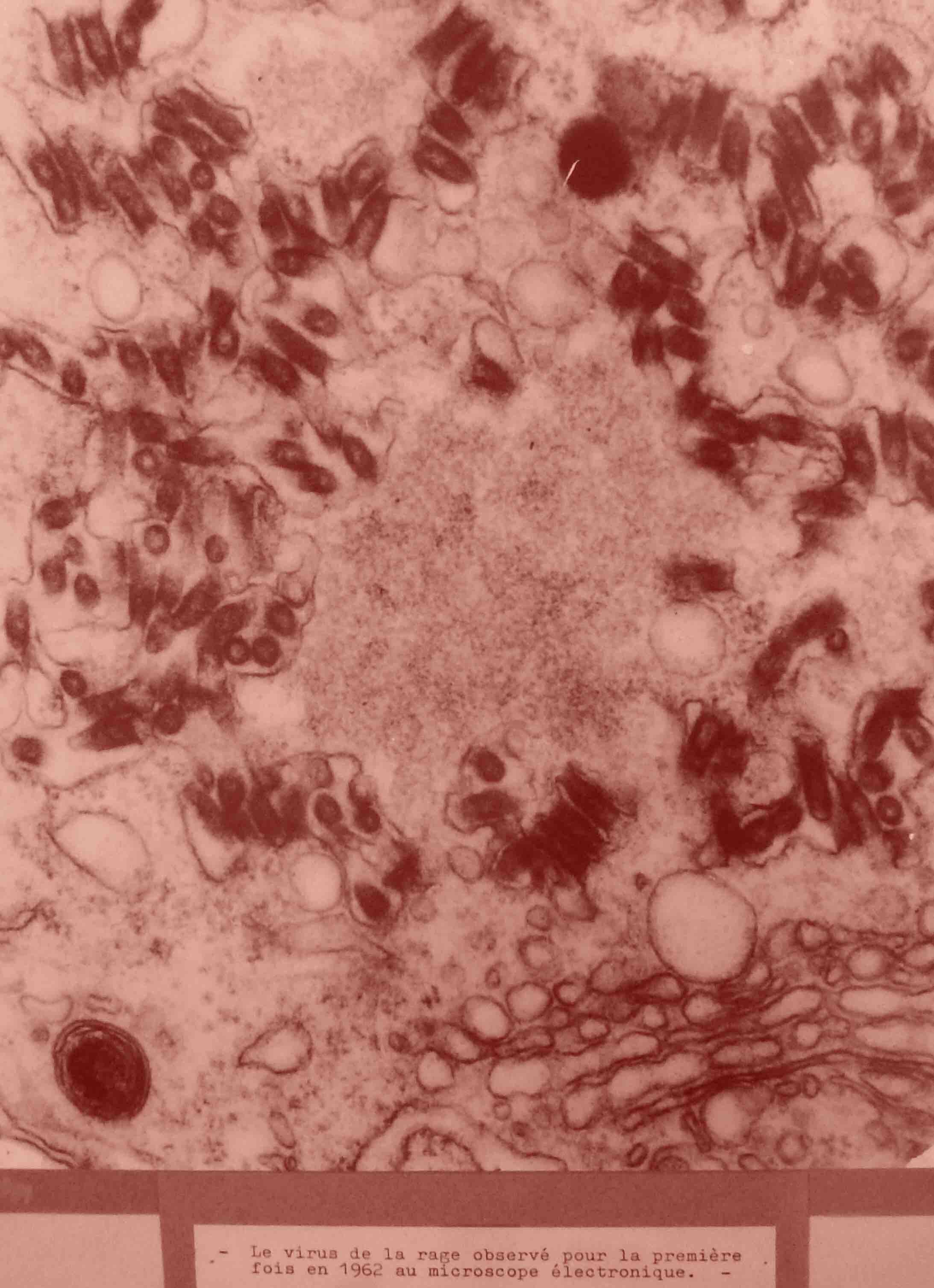 Quand le microscope devient électronique, le virus peut se dévoiler. Institut Pasteur de Lille.